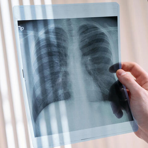 Radiographie - Pexels